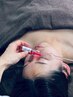 山梨初RED SHOT即効性、半永久、ダウンタイム無し顔の一部位脂肪ケア７０分