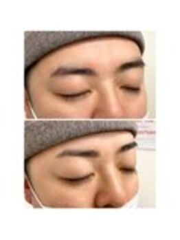 アイビー 神保町店(i.b)/眉【before⇒after】８６