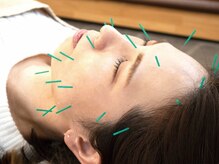 はぴねす鍼灸整骨院 高槻院