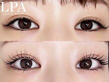 レピア 仙台店/韓国式LEPIA Before&Aｆter