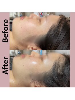 ミスティビオ 平尾店(mistyBIO)/《韓流艶肌》