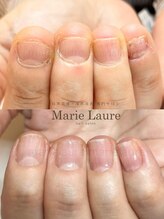 マリーロール 梅田店(Marie Laure)/深爪矯正/自爪育成/自爪風