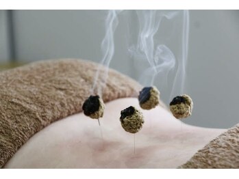 ブロッサム(Blossom)/鍼灸施術で血流改善☆冷え改善