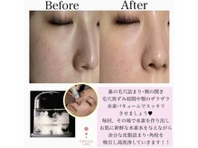 ポアレスラボ 新宿マルイ本館店/★人気No1★毛穴改善コース