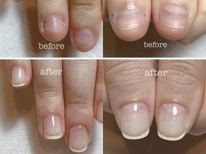 シュプール(Spur)の写真