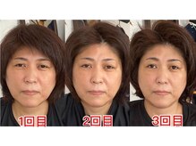 あいはな/よもぎ蒸×リンパ×小顔×頭蓋骨