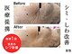 アバナ(ABANA)の写真