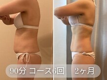 ラシク 吉祥寺(LACHIC)/上半身の厚みスッキリ