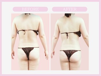 スリムライン 山形店(The Slim Line)/before→after