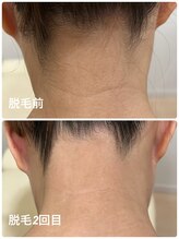 ベルマタン(belle matin)/すっきり美うなじで後ろ姿魅力UP