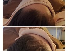 ボディ&フェイスに合わせて、脳ミソとろけるドライヘッドスパ