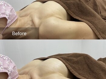 エクラニーク(Eclanique)/育乳、下垂のお悩みの方！