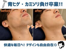 メンズ脱毛 マックス 蒲田店(MAX)の雰囲気（毛や肌のお悩みもお気軽にご相談ください！[蒲田/メンズ脱毛]）