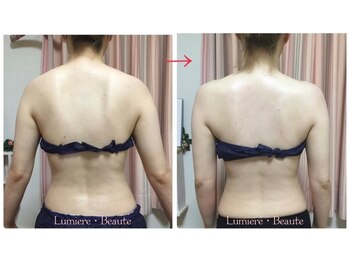 リュミエールボーテ/ブライダル・キャビ＆石膏パック