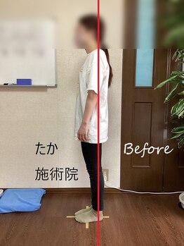 たか施術院/ブライダル 約１か月激変！