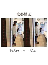 心斎橋長堀フェムテック整骨院/14姿勢矯正　骨格矯正と骨盤矯正