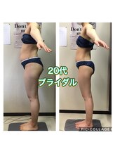 美ボディラボ(美Body Labo)/20代ブライダル