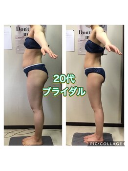 美ボディラボ(美Body Labo)/20代ブライダル