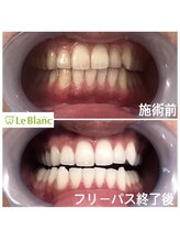 ルブラン 奈良店(Le Blanc)/食事制限ございません！