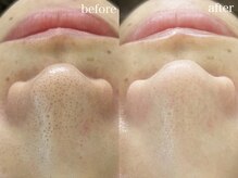 テオリア(TEORIA)/