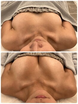 美人バスト 浜松店/◆バストアップ &nbsp;BeforeAfter◆