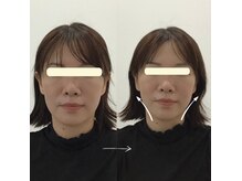小顔×姿勢改善 KISHI BEAUTY SALONの雰囲気（人気の小顔矯正で理想のフェイスラインへ）