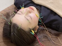 チキバンビューティーサロンの雰囲気（美容鍼×マッサージで小顔&肩こり,腰痛や日々の疲れを同時ケア◇）