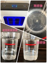 ワンアップ(One-up)/【STEP.12】施術後