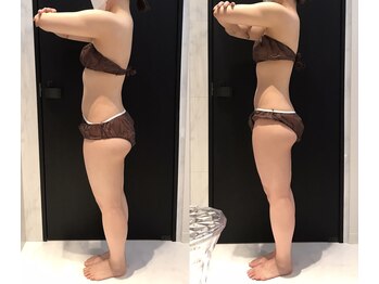 リボディ 表参道(An re Body)/before→after