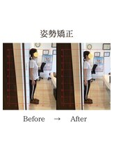 心斎橋長堀フェムテック整骨院/15姿勢矯正　骨格矯正と骨盤矯正
