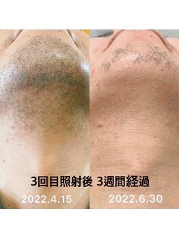 クリア アイラッシーズ アンド ネイルサロン シャイン(CLEAR & SHINE)/