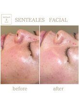 サロン ド ブラン アオヤマ(Salon de BLANC AOYAMA)/SENTEALES