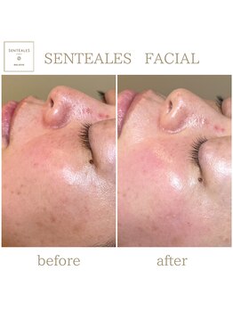 サロン ド ブラン アオヤマ(Salon de BLANC AOYAMA)/SENTEALES