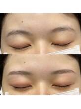 顔肌革命 ビューティアンドヘルス バイ メール(beauty&health by mer)/眉毛ワックス脱毛