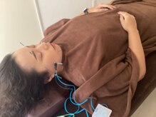 ハリファ鍼灸院 横浜関内院(HariFa鍼灸院)/美容施術