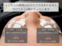 アンドミー(&me)/通常エクとLEDエクの検証