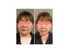 【2-3回目の方】感動実感!!【むくみ】小顔フェイシャル 70分 ¥8800→