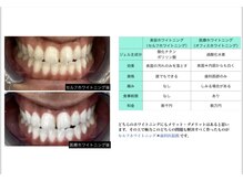 ファミリーセルフサロン 輪(Wa)/医療提携×セルフホワイトニング