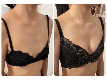 モナンジュ(ramonange)/細身のお客様　バストアップ