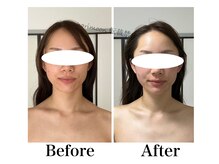 ハリムーン 仙台(harimoon)/ブライダル