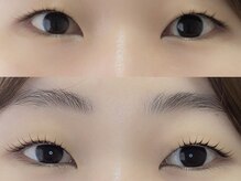 シャール(shall)/まつ毛パーマ/まつげ/マツパ