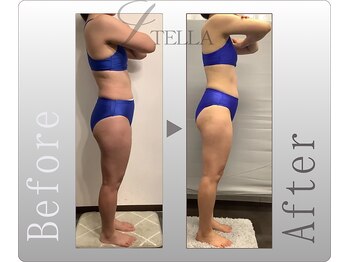 ステラ(STELLA)/全身プレミアムの効果