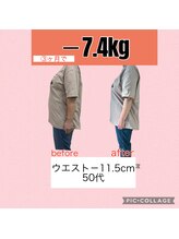 ヴェリテ(Verite)/before after