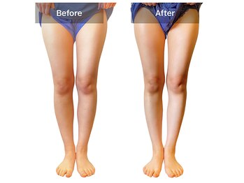 ベンザイ 新潟店(BENZAI)/脚がこんなに軽くなった！