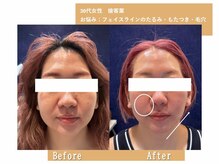 ロイボーテ(ROI Beaute)の雰囲気(当店1番人気のソニックフィットあらゆるお悩みにアプローチ◎)