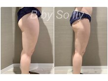 ビードット バイ ソーフライ(B.by So fly)の雰囲気(藤沢初!顔もボディも最新痩身!落ちにくい太もももスッキリ♪)
