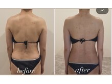 TMサロン 赤坂の雰囲気（もっこり肩はインナーケアから変わります！）