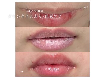 ベル 大和(Belle)/ローマピンク|リップケア