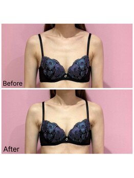 ククナ 長岡西店(KUKUNA)/バストケアコース