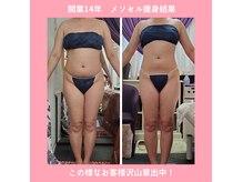 痩身専門サロン ラシュエット(La Chouette)の雰囲気（「メソセル全身」3ヶ月の結果！落としたかったお腹がスッキリ♪）